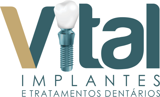Vital Implantes